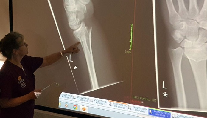 Five organisations announced for share of £240K in AI Fracture Diagnosis Programme